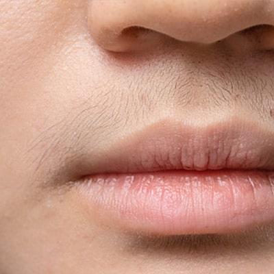 Unwanted Hair Removal Treatment